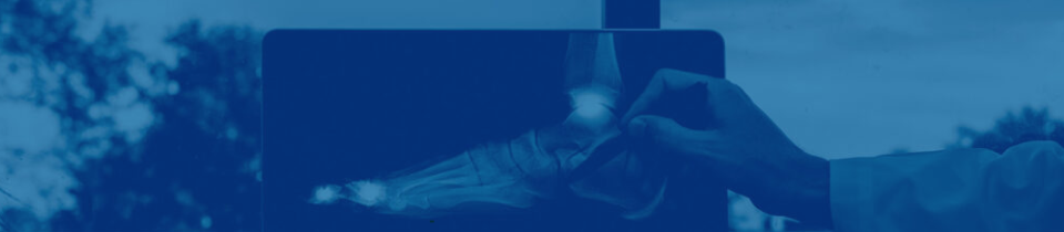 Joint Replacement Surgery | Dr Jason Ward | Orthopaedic Surgeon